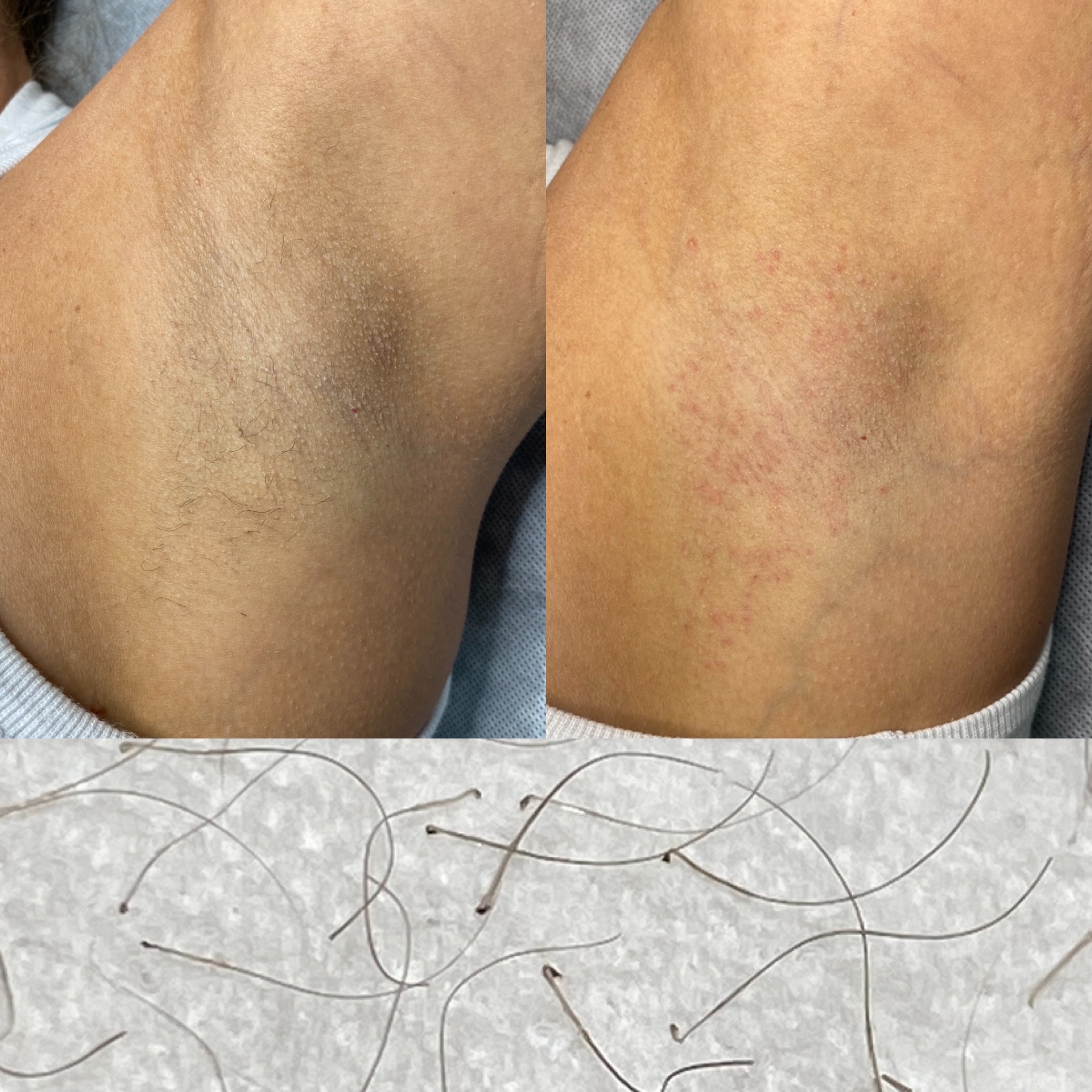 Client result