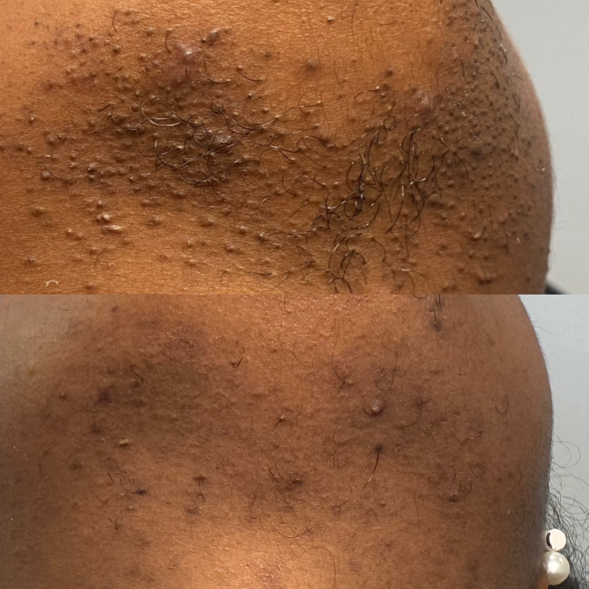 Client result