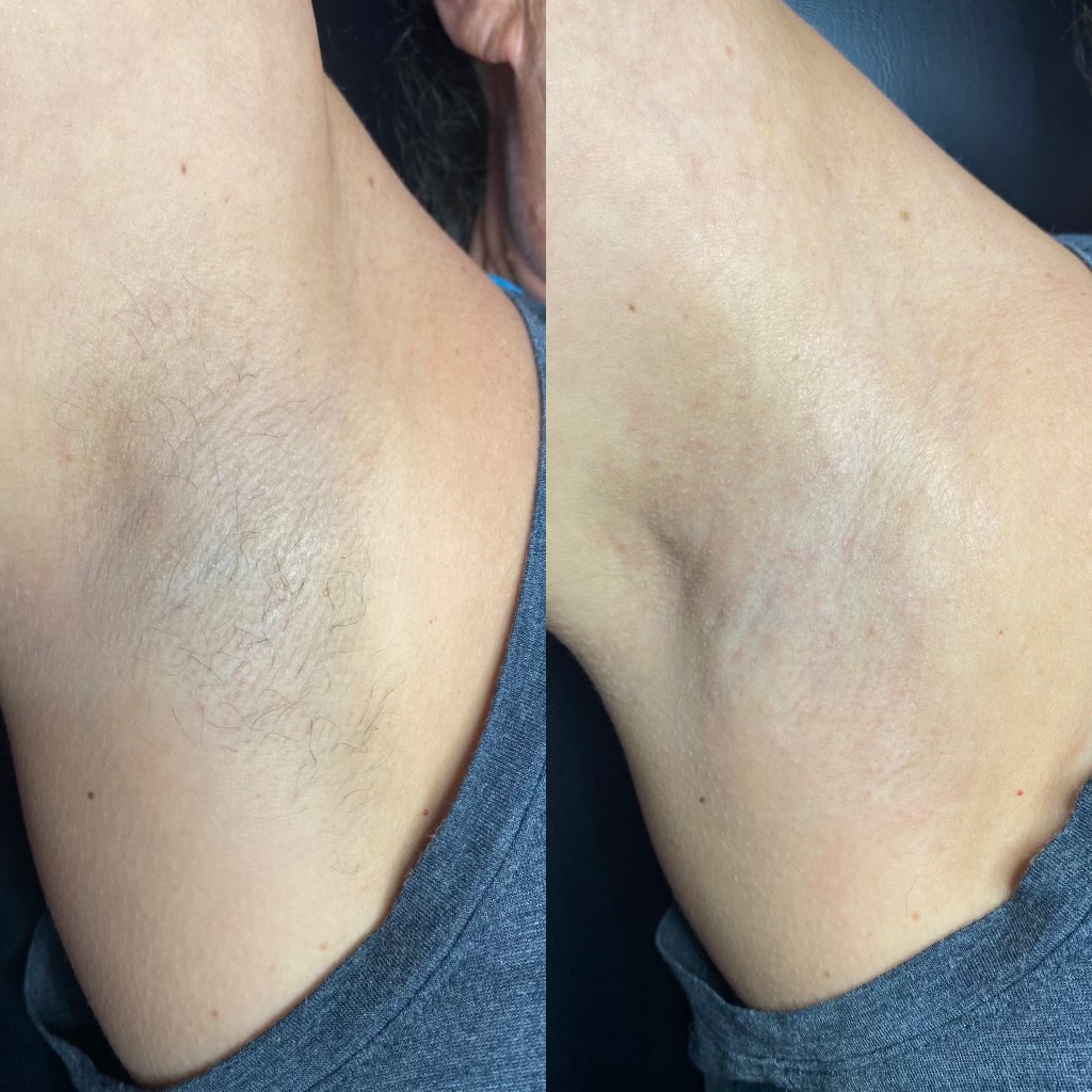 Client result